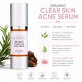Organic Clear Skin Anti Acne Serum - Oil Regulation Serum
